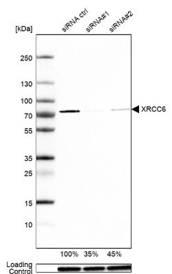 Ku70/XRCC6 Antibody, Novus Biologicals:Antibodies:Primary Antibodies